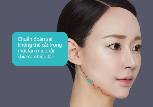 Chuẩn đoán sai không thể cắt trong một lần mà phải chia ra nhiều lần