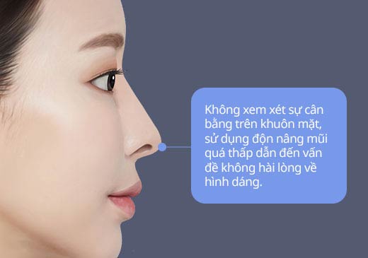 Không xem xét sự cân bằng trên khuôn mặt, sử dụng độn nâng mũi quá thấp dẫn đến vấn đề không hài lòng về hình dáng.